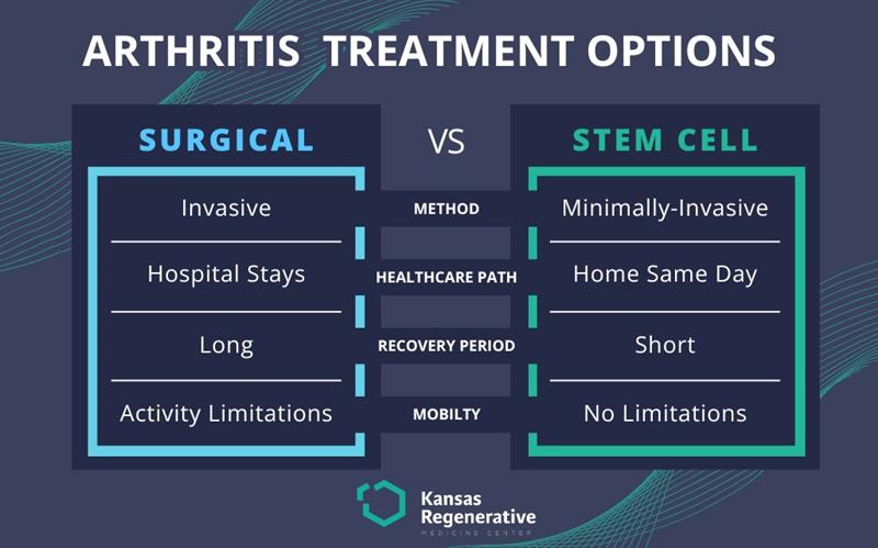KRMC Arthritis Treatment Surgical vs Stem Cell