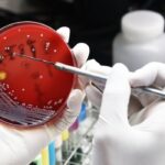 scientist with rubber gloves inspecting a red petri dish
