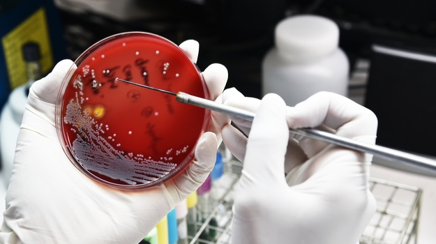 scientist with rubber gloves inspecting a red petri dish